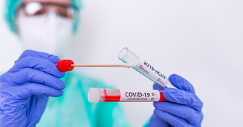 Vplyv hladiny magnézia v sére na priebeh covid-19